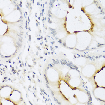 Anti-CCL22 Antibody (CAB1966)