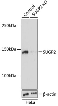 Anti-SUGP2 Antibody [KO Validated] (CAB19888)