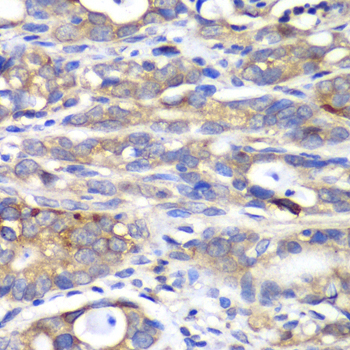 Anti-HAPLN1 Antibody (CAB12429)