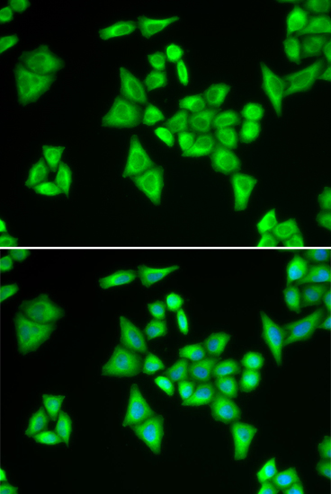 Anti-ADSL Antibody (CAB6278)