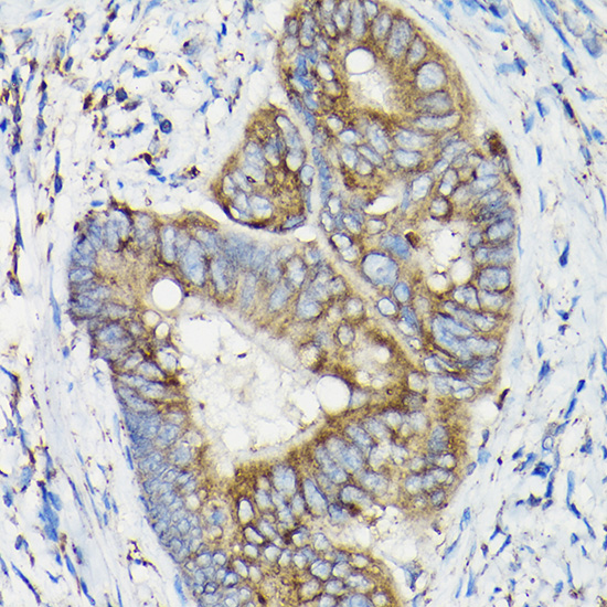 Anti-SIRT3 Antibody (CAB17113)