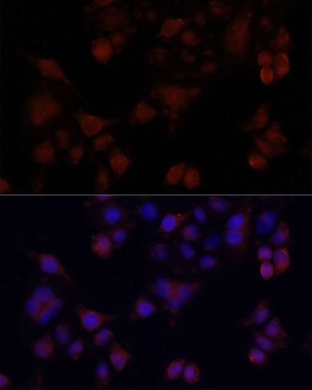 Anti-MAPRE1 Antibody (CAB2614)