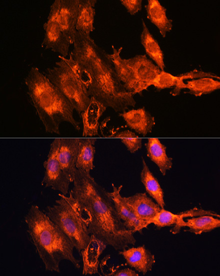 Anti-FSTL1 Antibody (CAB15789)