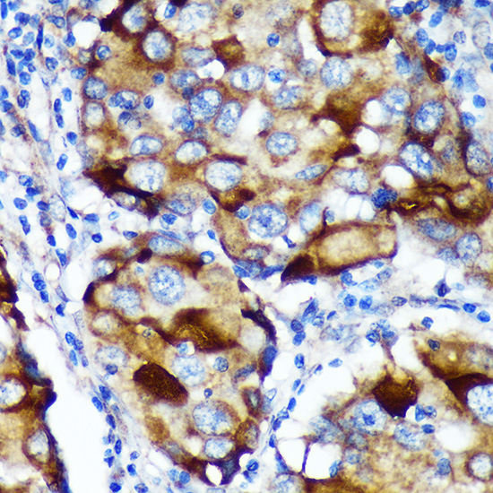 Anti-ABCF3 Antibody (CAB15168)