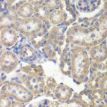 Anti-H6PD Antibody (CAB6440)