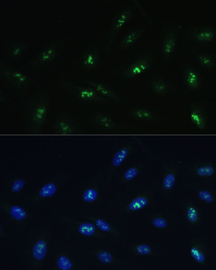 Anti-HNF4G Antibody (CAB16051)