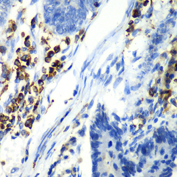 Anti-ASGR1 Antibody (CAB6871)