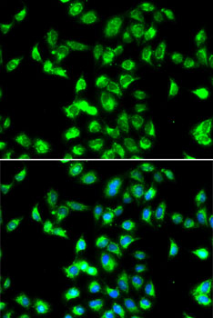 Anti-SERPINA4 Antibody (CAB7320)