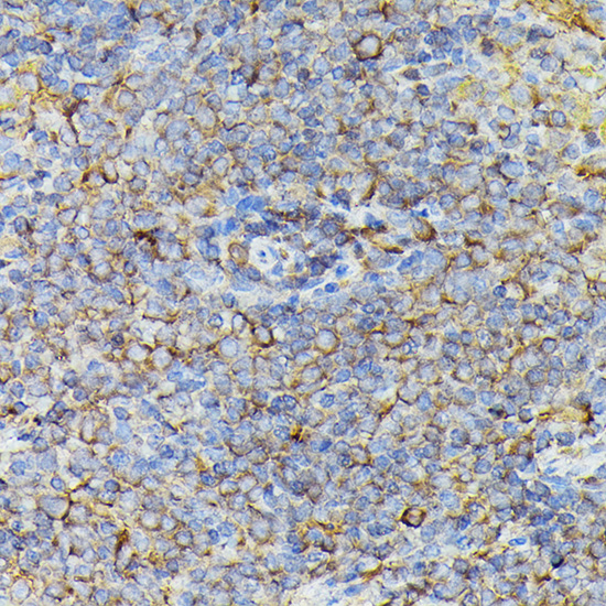 Anti-JAK2 Antibody (CAB11497)