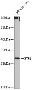 Anti-SYF2 Antibody (CAB14396)