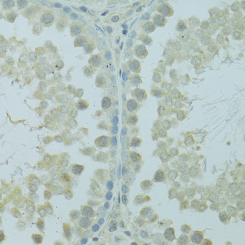 Anti-HUS1B Antibody (CAB14655)