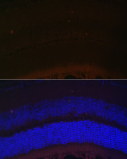 Anti-RDH5 Polyclonal Antibody (CAB8055)