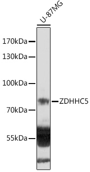 Anti-ZDHHC5 Antibody (CAB18114)