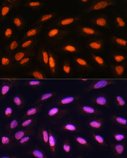 Anti-KAT2B Antibody (CAB0066)