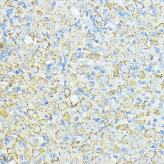 Anti-SOD3 Antibody (CAB6984)