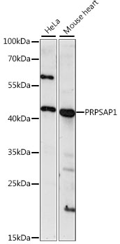 Anti-PRPSAP1 Antibody (CAB15710)