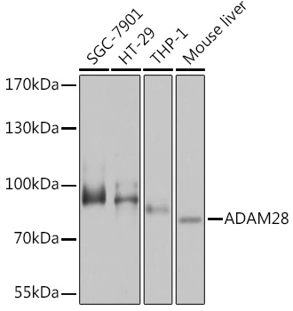 Anti-ADAM28 Antibody (CAB14849)
