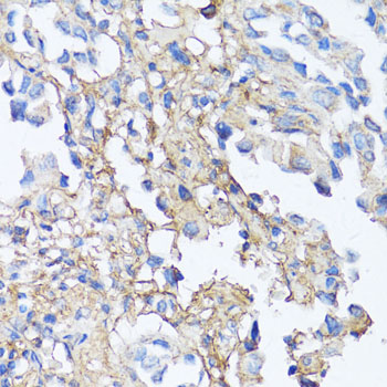 Anti-Fibronectin Antibody (CAB12932)