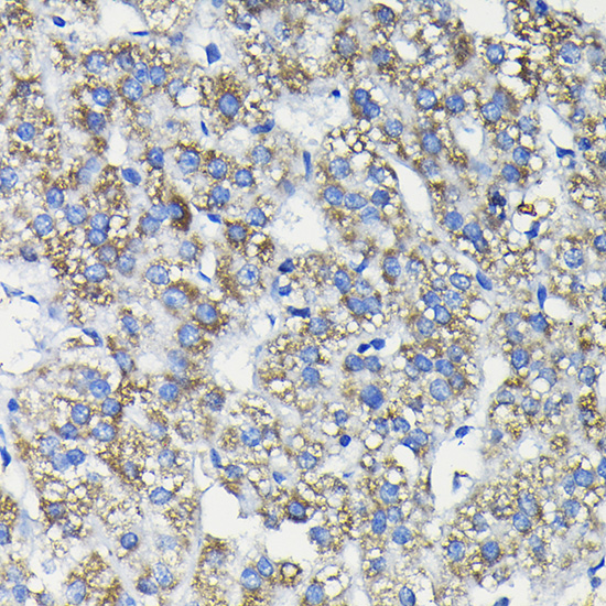 Anti-FUCA2 Antibody (CAB12211)