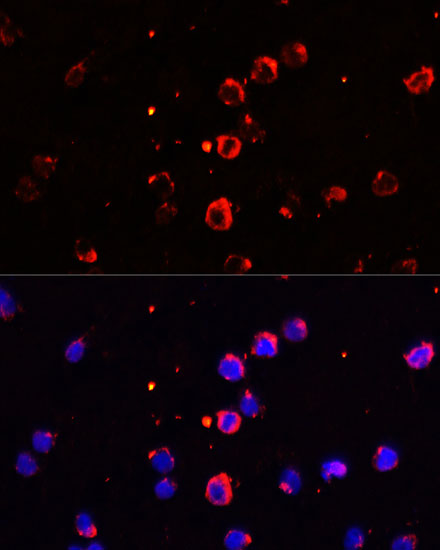 Anti-IL-1 beta Antibody (CAB1112)