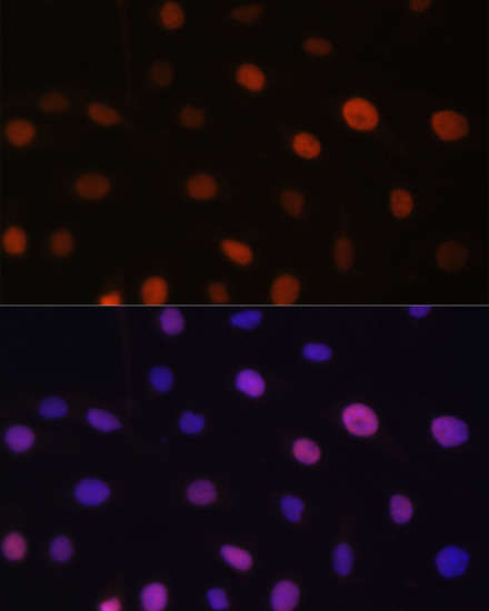 Anti-UHRF2 Antibody (CAB13602)