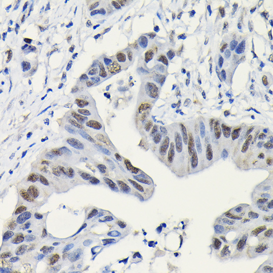 Anti-PARP1 Antibody [KO Validated] (CAB0942)