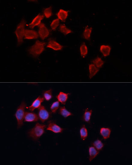 Anti-Caspase-8 Antibody (CAB11324)