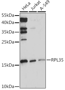 Anti-RPL35 Antibody (CAB17632)