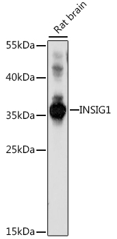 Anti-INSIG1 Antibody (CAB16278)