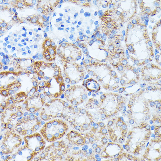 Anti-KCNJ15 Antibody (CAB15282)