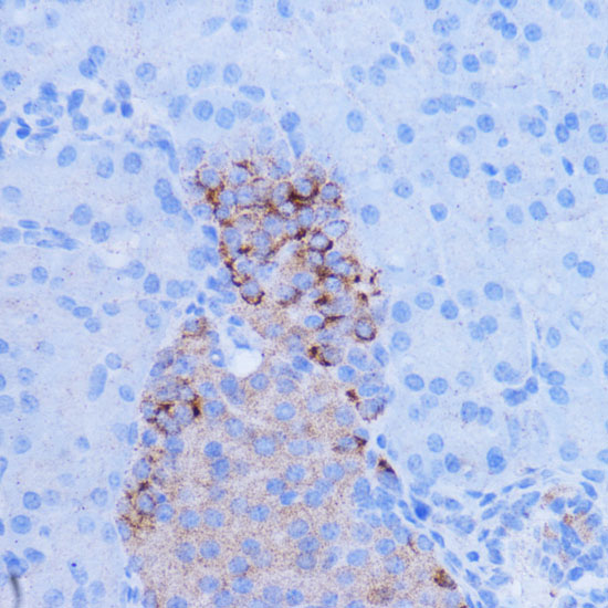 Anti-NDUFB9 Antibody (CAB17454)