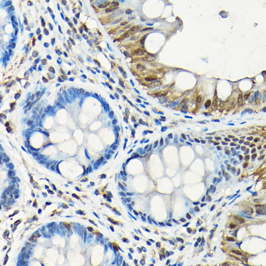 Anti-Smad5 Antibody (CAB1947)