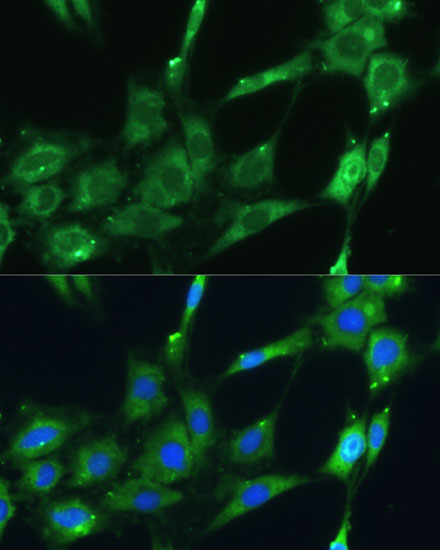 Anti-SPARC Antibody (CAB14494)