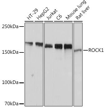 Anti-ROCK1 Antibody (CAB11158)