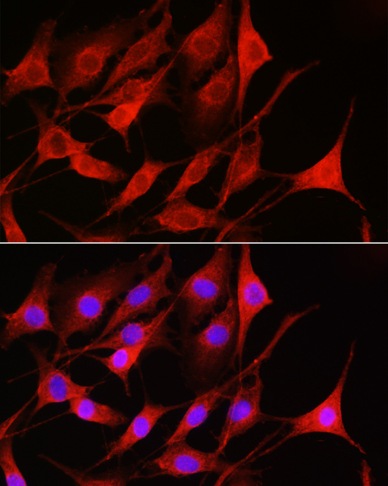 Anti-RAC1 Antibody (CAB7720)