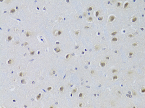 Anti-CDKN1B/p27KIP1 Antibody [KO Validated] (CAB0290)