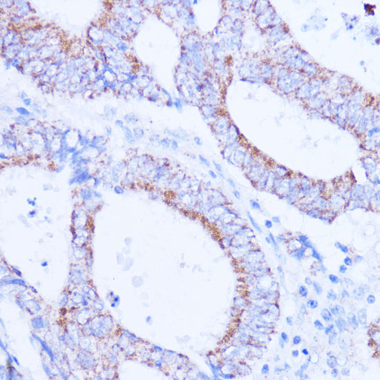 Anti-SIRT3 Antibody (CAB7307)