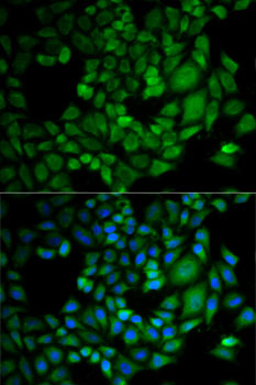 Anti-AKR1C3 Antibody (CAB13568)