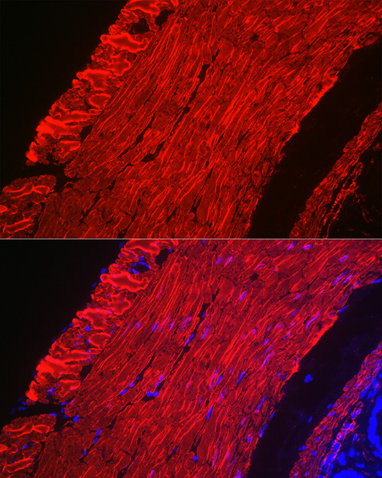 Anti-alpha smooth muscle actin Antibody (CAB1011)