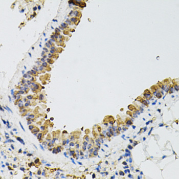 Anti-ARHGEF2 Antibody (CAB12547)