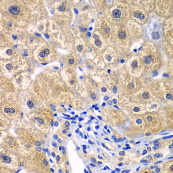 Anti-CARD11 Antibody (CAB7140)