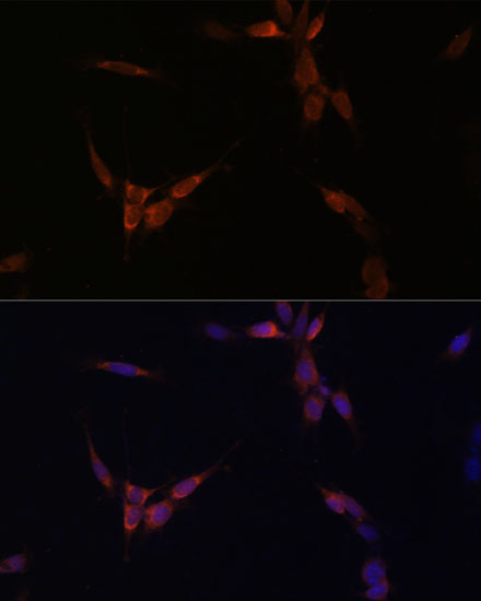 Anti-PPP2CA Antibody (CAB6702)