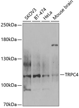 Anti-TRPC4 Antibody (CAB6996)