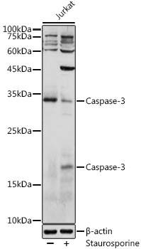 Anti-Caspase-3 Antibody [KO Validated] (CAB11040)