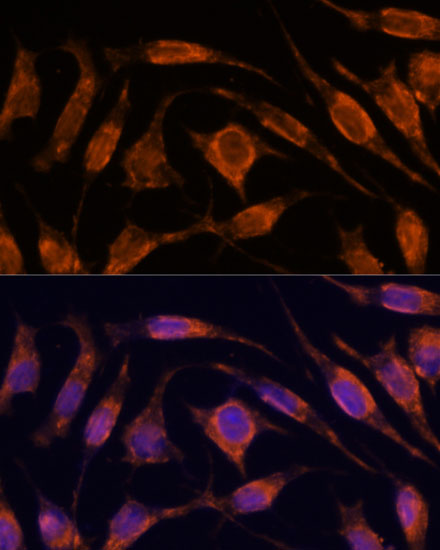 Anti-IPO4 Antibody (CAB15600)