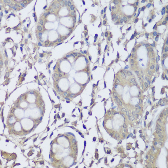 Anti-CKMT1B Antibody (CAB3046)