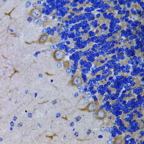 Anti-RARA Antibody (CAB0370)