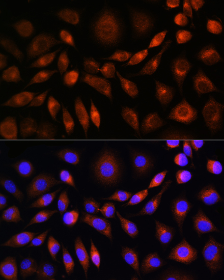 Anti-APOM Antibody (CAB5336)