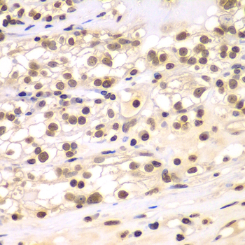 Anti-ULK4 Antibody (CAB7471)