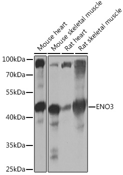 Anti-ENO3 Antibody (CAB16371)